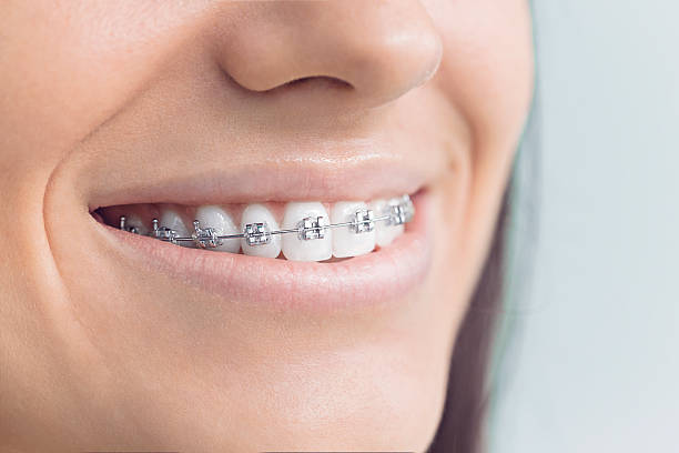 Best Dental Fillings (Composite and Amalgam)  in Blaine, WA